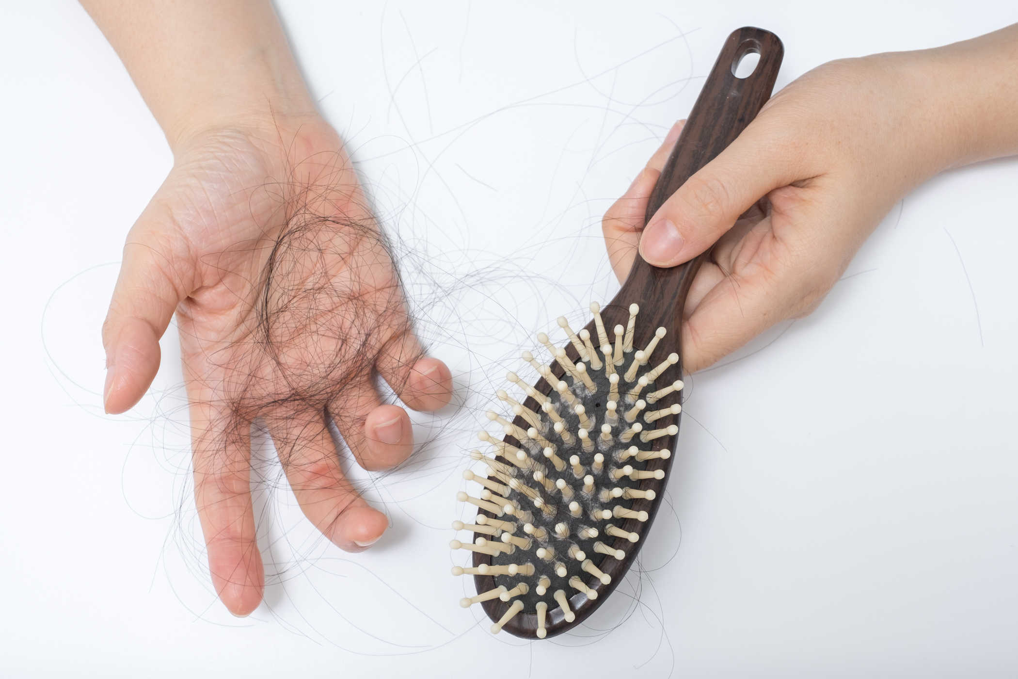 minyak kelapa untuk rambut rontok